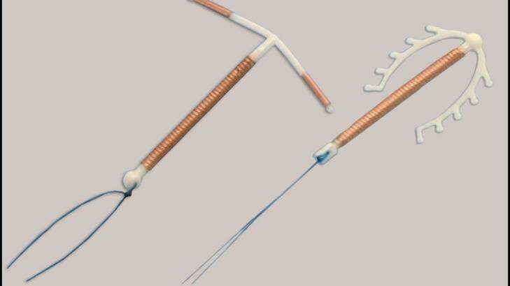 Copper intrauterine devices. Photo: Family Planning NSW